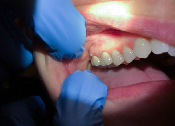 Best Emergency Treatment for Toothache in Minneota, MN